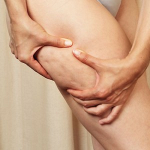 staminaline cellulite 300x300 Staminaline – Crema anticellulite Cadey con cellule staminali